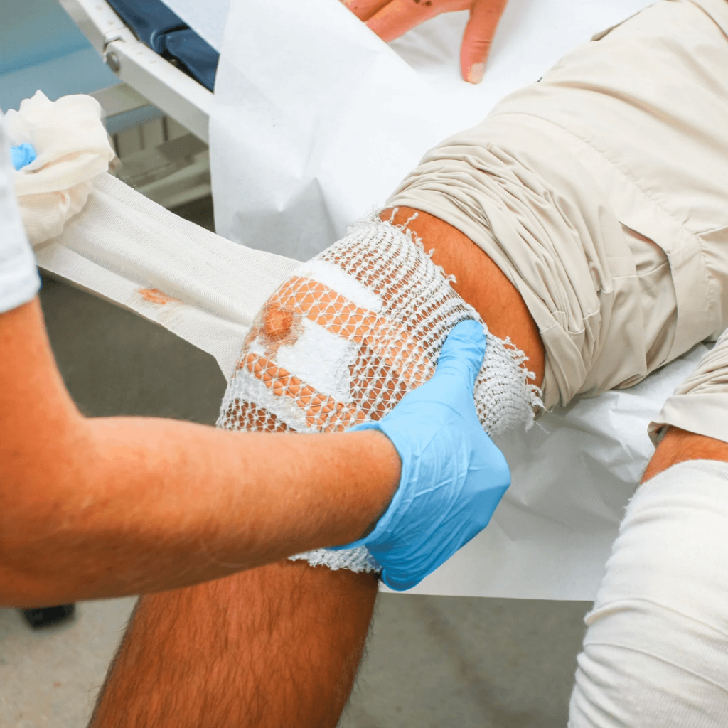 complex wound dressing